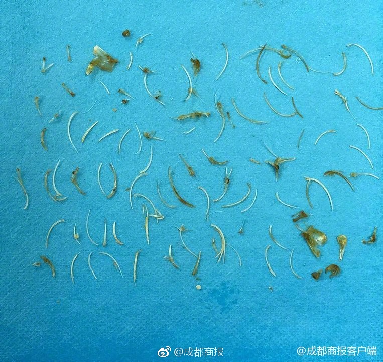 新朋老友共享中国服贸机遇